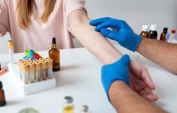 Allergy Lab